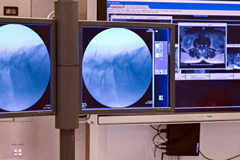 고주파수핵감압술 사진